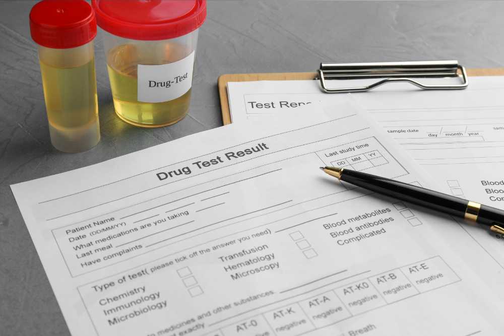 drug test form with two urine samples