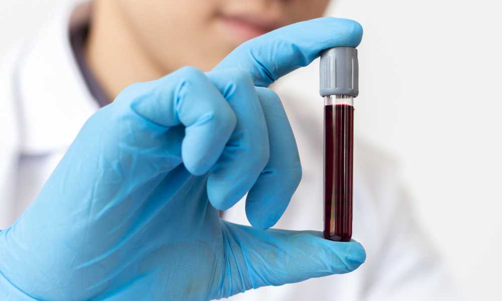 doctor holding blood sample vial