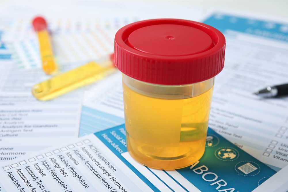 a urine sample on top of papers